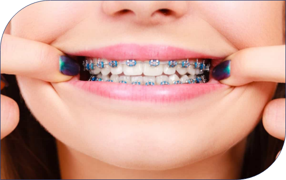 Orthodontic Solutions