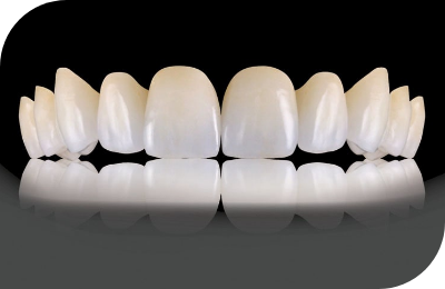 Zirconia Crowns